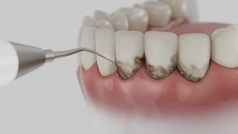 Trusted Wisdom Tooth Removal service in Barview, OR - Dentist Open Now